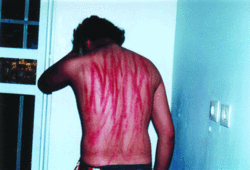 In Turchia è reato essere obiettori di coscienza.