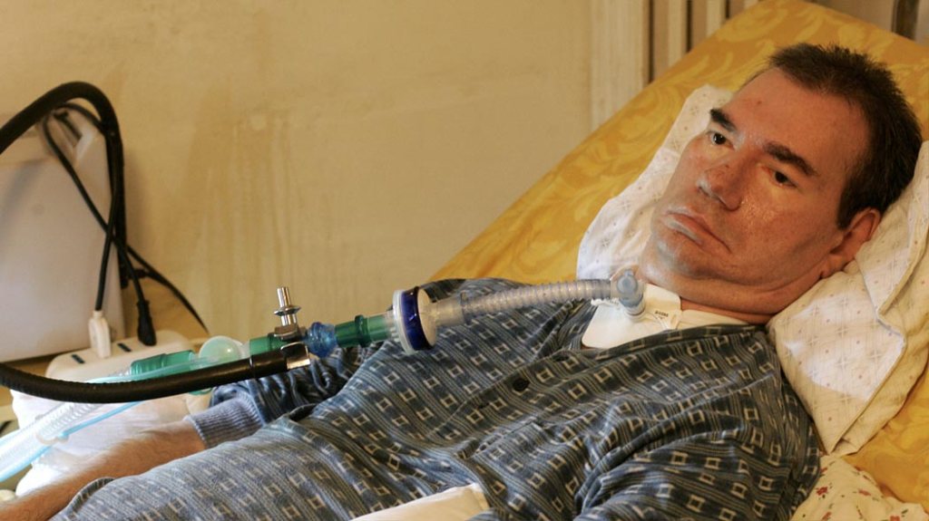 Eutanasia, Piergiorgio Welby è morto