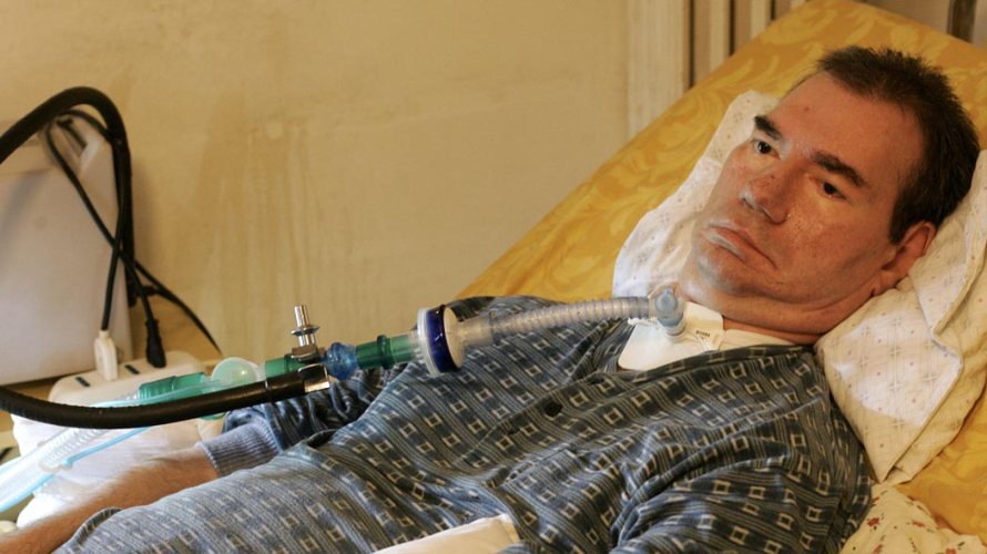 Eutanasia, Piergiorgio Welby è morto